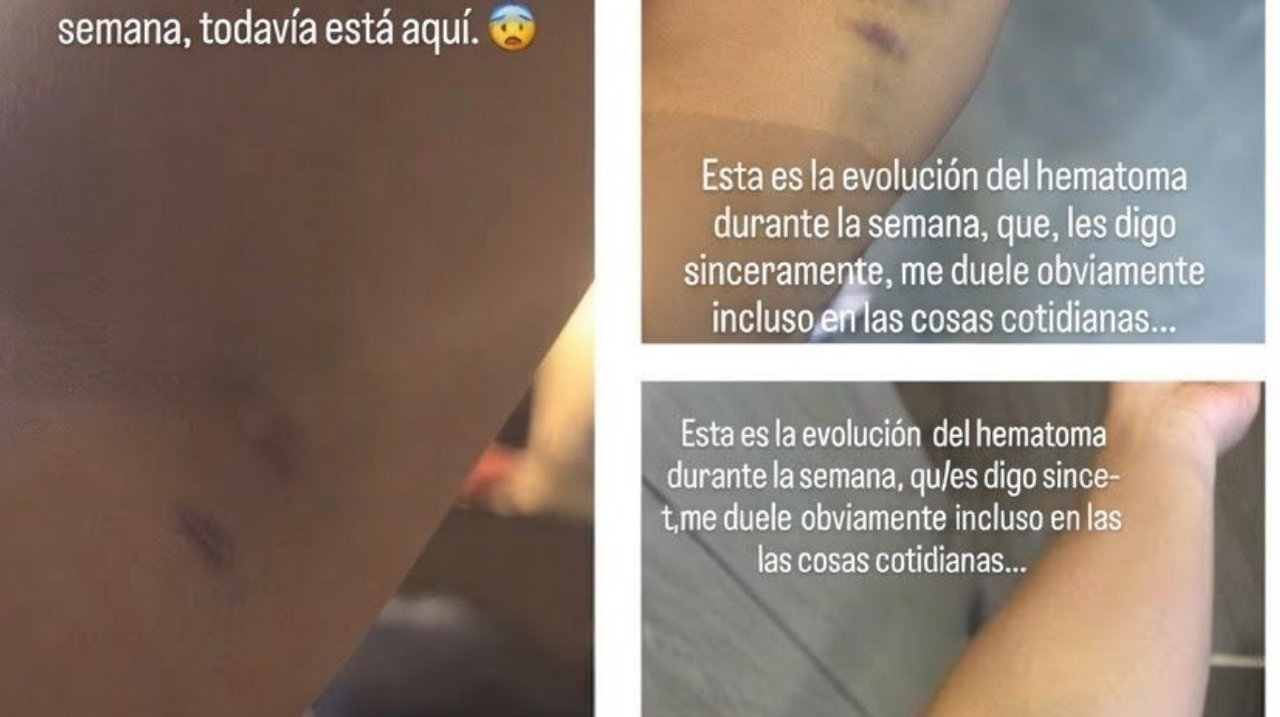 OFI克里特VS霍芬海姆直播_OFI克里特VS霍芬海姆直播免费在线观看_OFI克里特VS霍芬海姆直播免费直播视频直播